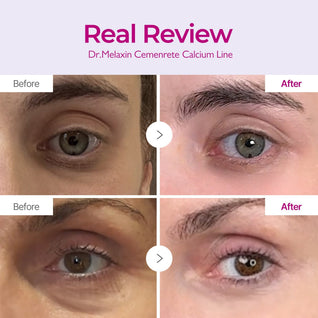 Cemenrete Calcium Intense Ampoule